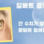 갑자기 황달 생긴다면 길버트 증후군 증상 진단 약 치료법