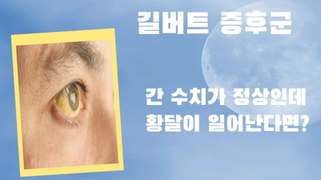 갑자기 황달 생긴다면 길버트 증후군 증상 진단 약 치료법