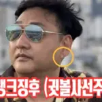 귓볼 사선 주름 프랭크 징후 뭐길래 (ft. 이경규 김수용 사망할뻔 심혈관 이상 징조)